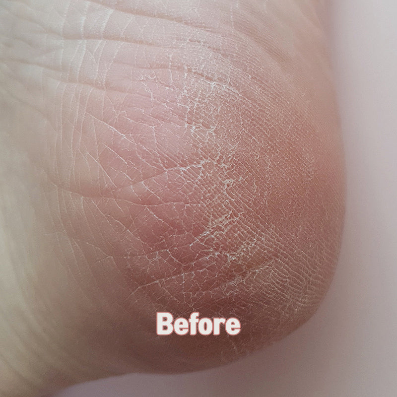 MADFORCOS Silky Coconut Oil Foot Mask 5 pc