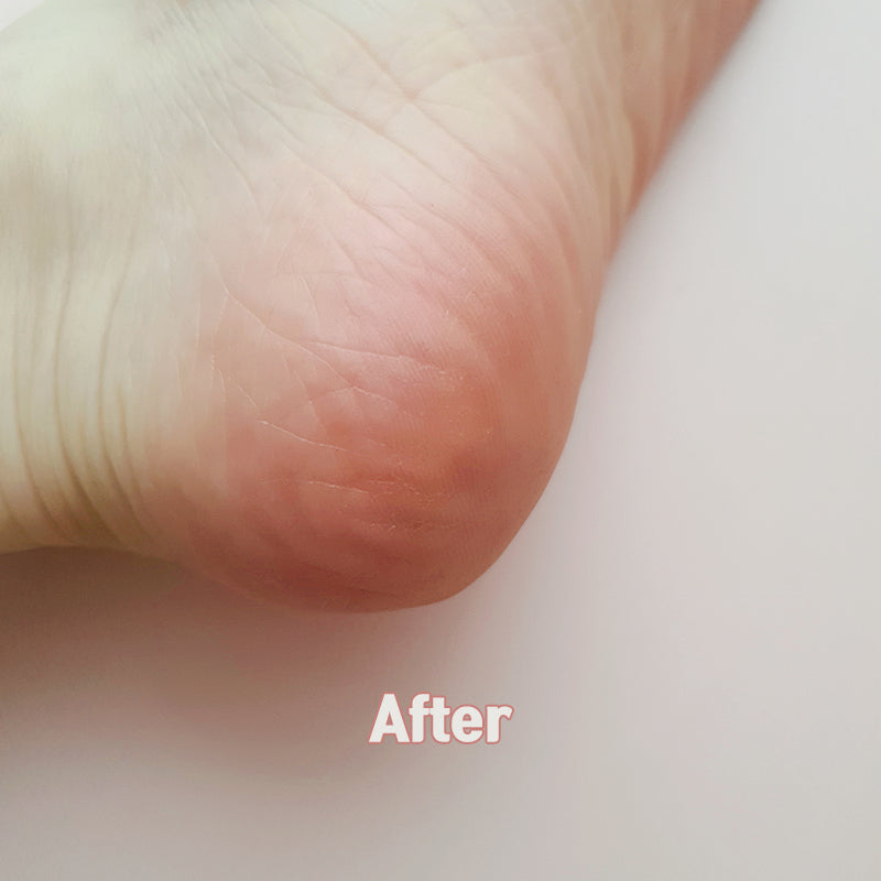 MADFORCOS Silky Coconut Oil Foot Mask 5 pc