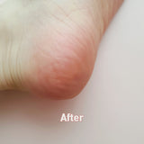 MADFORCOS Silky Coconut Oil Foot Mask 5 pc