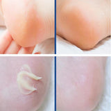 MEDIPEEL EGF Scaling Moisture Foot Cream 130g - Foot Care